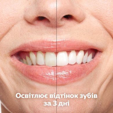 Электрическая звуковая зубная щетка Philips Sonicare HX9917/89 со стаканом, серии DiamondClean Smart 9400, черный, 2 насадки, дорожный зарядный кейс 3930568 Mams family